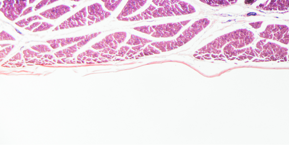 How to Stimulate Muscle Protein Synthesis